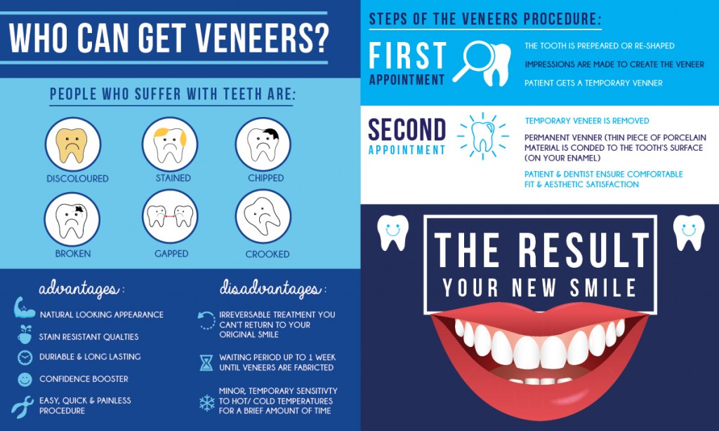 veneer-infograph